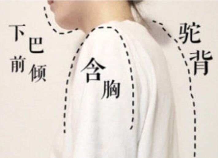 南寧美容學校：堅持一個月，駝背變直背