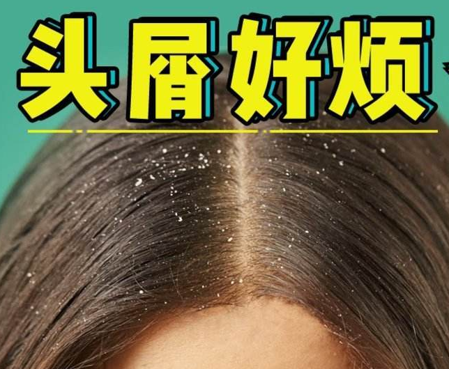南寧正規(guī)美發(fā)培訓(xùn)學(xué)校分享：冬天如何減少頭屑過多？