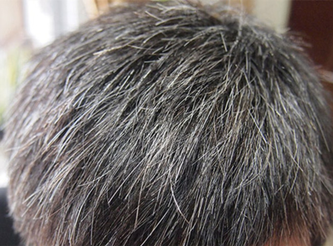 南寧美發(fā)基礎(chǔ)教學(xué)：為什么會長白頭發(fā)？