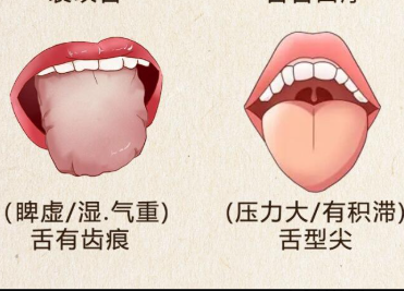 如何根據(jù)舌苔看健康 | 廣西美容美體培訓哪里正規(guī)